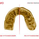 Chrániče zubů OPRO UFC  GOLD(červená/stříbrná) | JustBest.cz