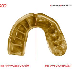 Chrániče zubů OPRO UFC  GOLD(červená/stříbrná) | JustBest.cz